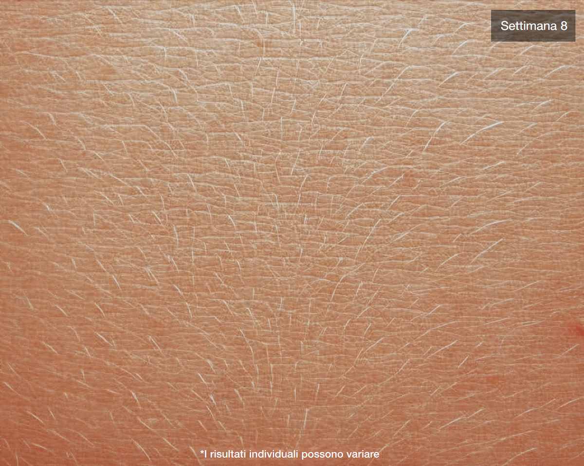 le-viareline-avant-apres / onglet 2 image « après »